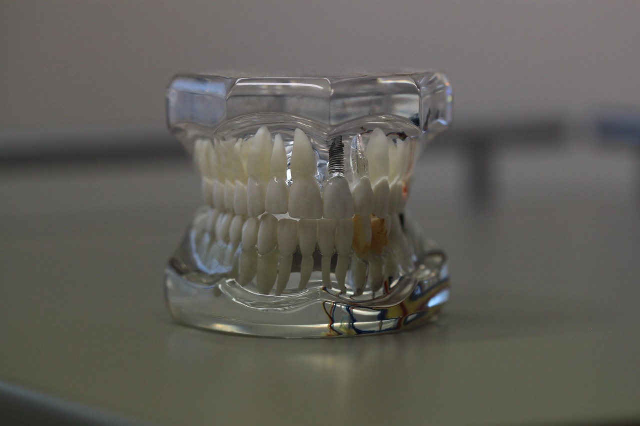 Dental prosthetics and models